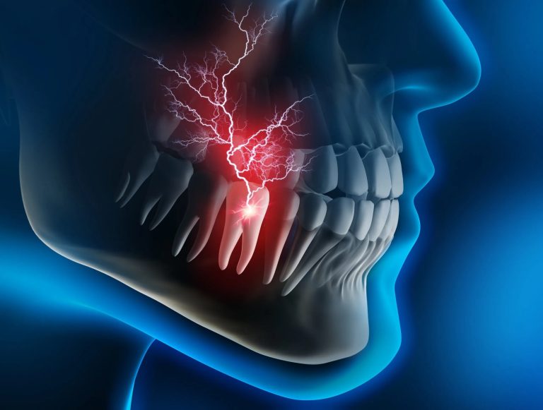 Understanding Tooth Pain Under Crown Comes and Goes: Causes and Solutions
